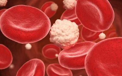 Alimentos que diminuem a glicose ( açúcar )